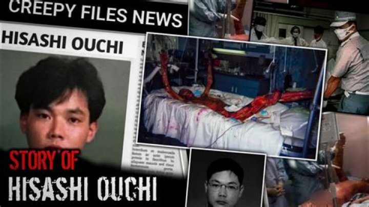 Hisashi Ouchi: The Tragic Story of a Nuclear Accident Victim