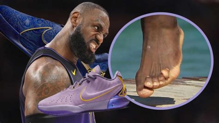 LeBron James Foot: Understanding the Impact of Foot Health on His Career
