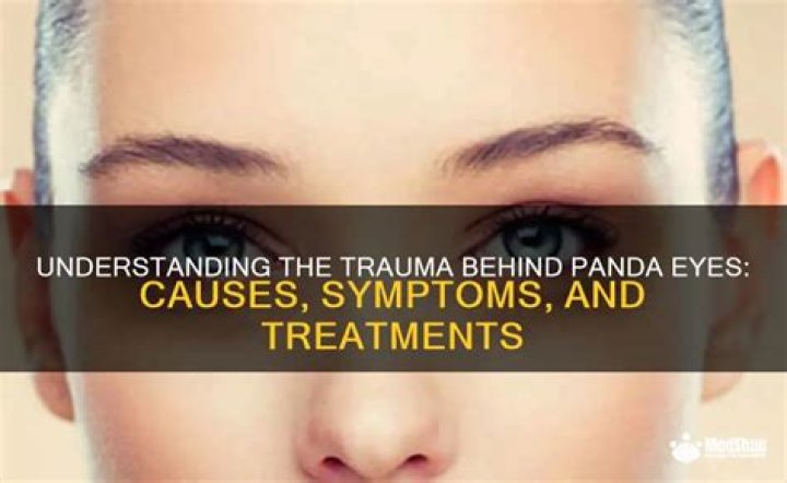 Panda Eyes: Understanding the Causes, Treatments, and Remedies