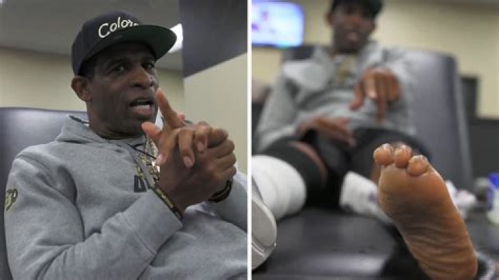 Understanding Deion Sanders Foot: A Comprehensive Guide